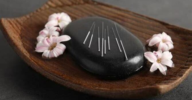 Traditional Acupuncture